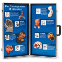 Die Folgen des Rauchens, 3D Schautafel Die Folgen des Rauchens, 3D Schautafel