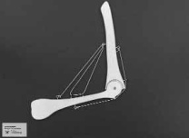 Funktionsmodell, Menschenarm, 50x30 cm Funktionsmodell, Menschenarm, 50x30 cm