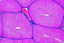 Mikropräparat - Leber, Schwein, quer, Leberläppchen, interlobuläres Bindegewebe Mikropräparat - Leber, Schwein, quer, Leberläppchen, interlobuläres Bindegewebe