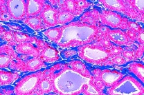 Mikropräparat - Schilddrüse vom Rind, quer, Kolloid Mikropräparat - Schilddrüse vom Rind, quer, Kolloid