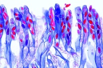 Mikropräparat - Peziza, Becherpilz, Apothezium mit Asci quer