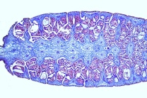 Mikropräparat - Equisetum, Schachtelhalm, Sporophyllstand längs