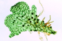 Mikropräparat - Farn, Vorkeim (Prothallium), total