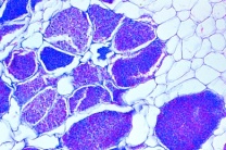 Mikropräparat - Plasmodiophora brassicae, Erreger der Kohlhernie, Algenpilz