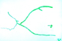 Mikropräparat - Laubmoos, Vorkeim (Protonema), total