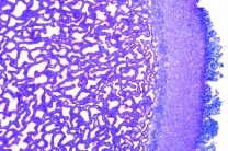 Mikropräparat - Scleroderma vulgare, Kartoffelbovist, Fruchtkörper quer