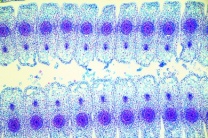 Mikropräparat - Tulipa, Tulpe, Fruchtknoten mit Samenanlagen, längs