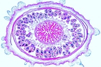 Mikropräparat - Papaver, Mohn, Blüte quer, Blütendiagramm Mikropräparat - Papaver, Mohn, Blüte quer, Blütendiagramm