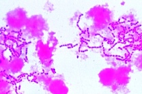 Mikropräparat - Streptococcus pyogenes, Eitererreger