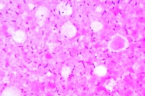 Mikropräparat - Bacterium erysipelatos, Erreger des Rotlaufs