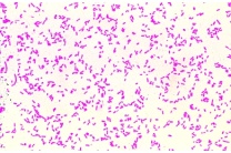 Mikropräparat - Eberthella (Salmonella) typhi, Typhuserreger, Ausstrich