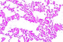 Mikropräparat - Salmonella enteritidis, Wurstvergiftung, Ausstrich Mikropräparat - Salmonella enteritidis, Wurstvergiftung, Ausstrich