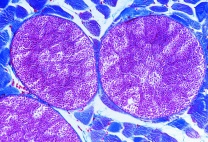 Mikropräparat - Sarcocystis sp., Schnitt durch infiziertes Muskelgewebe. Mieschersche Schläuche