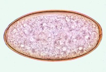 Mikropräparat - Fasciola hepatica, Eier aus dem Gallensediment vom Rind Mikropräparat - Fasciola hepatica, Eier aus dem Gallensediment vom Rind
