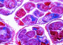 Mikropräparat - Schistosoma mansoni, Redien und Cercarien in einer infizierten Schneckenleber Mikropräparat - Schistosoma mansoni, Redien und Cercarien in einer infizierten Schneckenleber