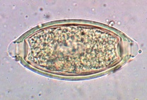 Mikropräparat - Trichuris trichiura, Peitschenwurm, Eier