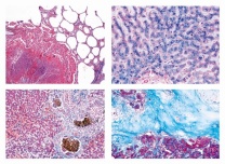 Mikropräparate - Pathologische Histologie des Menschen, Grundserie Teil I.  40 Präparate