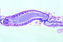 Mikropräparat - Periplaneta, Küchenschabe, Mitteldarm, Chylus, Malpighische Gefäße, quer