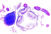 Mikropräparat - Periplaneta, Küchenschabe, Rectaldarm mit Ampullen, quer
