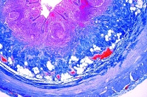 Mikropräparat - Wurmfortsatz des Blinddarms vom Menschen, quer Mikropräparat - Wurmfortsatz des Blinddarms vom Menschen, quer