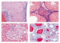 Mikropräparate - Hormone und Hormonfunktion, Sekundarstufe II, Serie IV, 7 Präparate mit Begleittext
