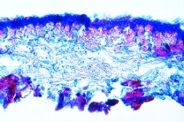 Mikropräparat - Durch Luftverschmutzung zerstörte Flechte, quer