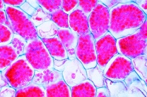 Mikropräparat - Wurzelknöllchen der Erle mit lebenswichtigen, aber empfindlichen symbiontischen Bakterien, quer