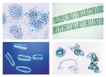 Mikropräparate - Unsere Umwelt II, Das Wasser, Die Gewässerverschmutzung, Ursachen und Kennzeichen 20 Präparate mit Begleittext Mikropräparate - Unsere Umwelt II, Das Wasser, Die Gewässerverschmutzung, Ursachen und Kennzeichen 20 Präparate mit Begleittext