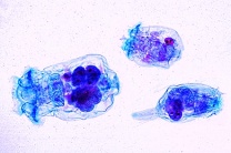 Mikropräparat - Rädertiere (Rotatoria), Massenvermehrung in faulstoffbelasteten Gewässern