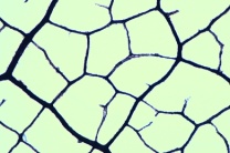 Mikropräparat - Verrottendes Laubblatt, Äderung. Humusbildung Mikropräparat - Verrottendes Laubblatt, Äderung. Humusbildung