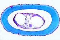 Mikropräparat - Flußkrebs, Antenne quer, Chitinpanzer, Außenskelett der Krebse Mikropräparat - Flußkrebs, Antenne quer, Chitinpanzer, Außenskelett der Krebse
