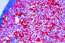 Mikropräparat - Frosch, Milz quer, Lymphatisches Gewebe Mikropräparat - Frosch, Milz quer, Lymphatisches Gewebe