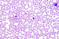 Mikropräparat - Kaninchen, Blut, Ausstrich