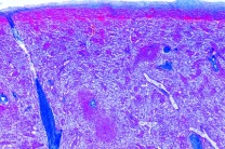 Mikropräparat - Kaninchen, Milz, quer