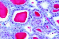 Mikropräparat - Kaninchen, Schilddrüse, quer