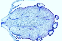 Mikropräparat - Erdbeere, Sammelnußfrucht längs Mikropräparat - Erdbeere, Sammelnußfrucht längs