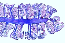 Mikropräparat - Haselnuß, männliche Blüte, längs