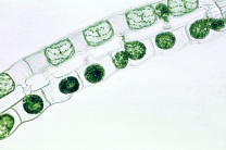 Mikropräparat - Spirogyra, Schraubenalge, Konjugationsstadien und Zygoten