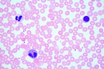 Mikropräparat - Blut des Menschen, Ausstrich, Giemsafärbung zur differenzierten, Darstellung