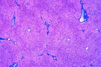 Mikropräparat - Leber des Menschen, quer, Leberzellbalken, Gallengefäße