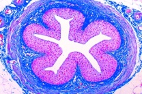 Mikropräparat - Harnleiter (Ureter) des Menschen, quer