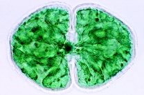 Mikropräparate - Das Leben im Wassertropfen Teil II, Die Kleinlebewelt unserer Gewässer, 25 Präparate mit Begleittext Mikropräparate - Das Leben im Wassertropfen Teil II, Die Kleinlebewelt unserer Gewässer, 25 Präparate mit Begleittext