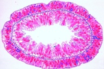 Mikropräparat - Hydra, Süßwasserpolyp, Querschnitte durch verschiedene Körperregionen: Ekto- und Entoderm, Nesselzellen