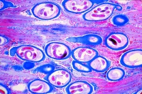 Mikropräparate in Serie - Verschiedene Larvenformen, 10 Präparate