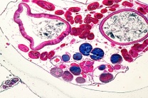 Mikropräparate in Serie - Schädellose Tiere (Cephalochordata), 10 Präparate Mikropräparate in Serie - Schädellose Tiere (Cephalochordata), 10 Präparate