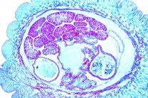 Mikropräparat - Schnecke, junges Tier, Körpermitte, quer Mikropräparat - Schnecke, junges Tier, Körpermitte, quer