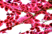 Mikropräparat - Schmetterling, Tracheenäste mit verzweigten Atemröhren, total
