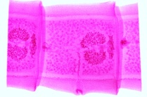 Mikropräparate in Serie - Würmer (Helminthes),  20 Präparate