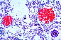 Mikropräparat - Spongilla, Süßwasserschwamm, quer. Kieselschwamm Mikropräparat - Spongilla, Süßwasserschwamm, quer. Kieselschwamm