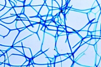 Mikropräparat - Euspongia, Badeschwamm, Schnitt mit Geißelkammern und Skelettelementen. Hornschwamm Mikropräparat - Euspongia, Badeschwamm, Schnitt mit Geißelkammern und Skelettelementen. Hornschwamm